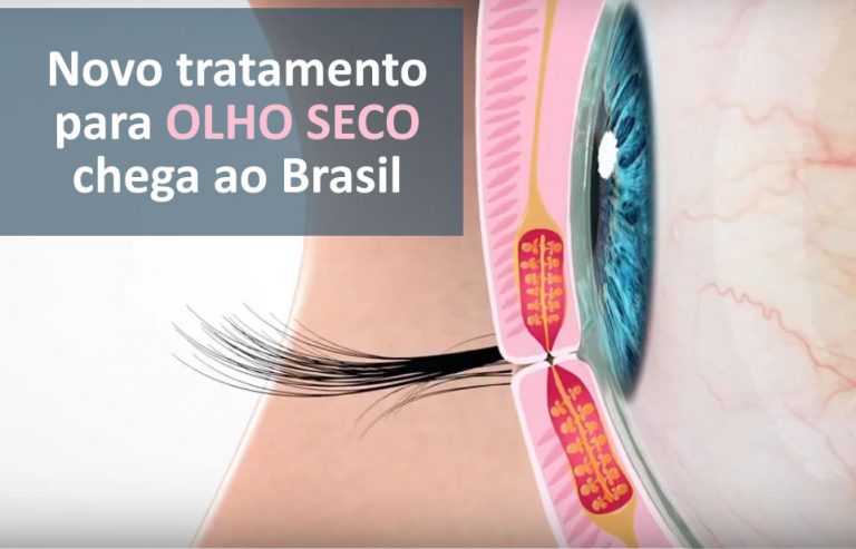 tratamento para olho seco em Curitiba